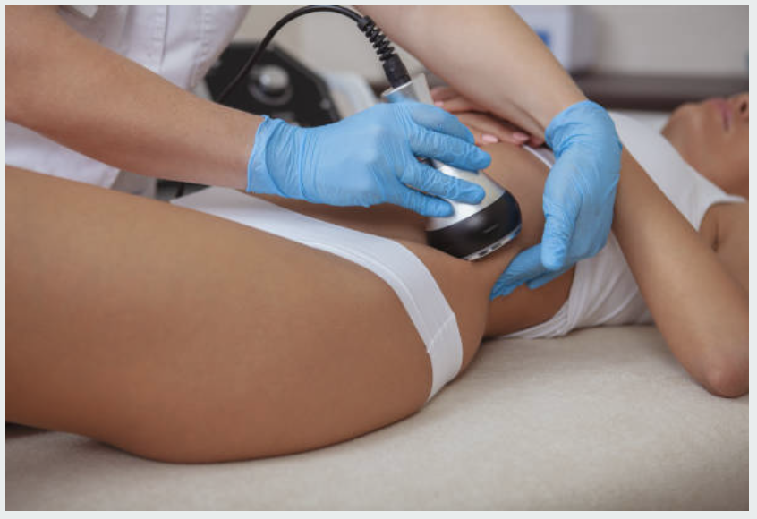 Illustration showing the science and effects of body cavitation treatment
